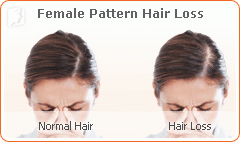 Hair Loss Solutions