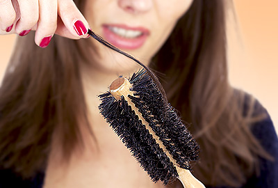 Hair Loss in Women Over 40