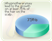 Hair loss news