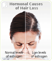 Hair Loss At The Temples Causes Prevention  Treatments  Este