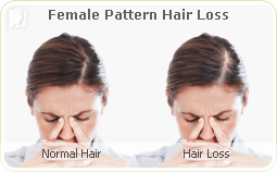 Hair Loss 1