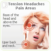 Types of Headaches 1