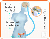 Understanding and Coping with Menopause Hot Flashes2