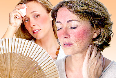 Hot Flashes during Menopause