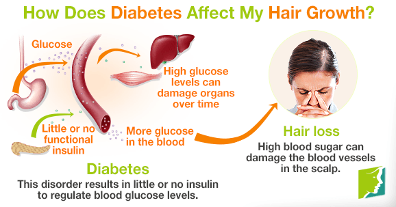 How Does Diabetes Affect My Hair Growth?