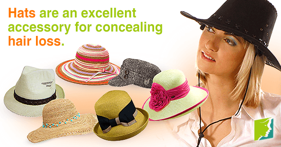 Hats are an excellent accessory for concealing hair loss