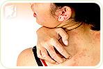 How to Cope with Itchy Skin in Menopause