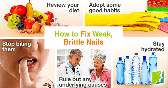 Hot to fix weak, brittle nails