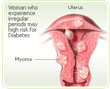 Uterus