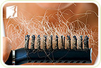 Increased Hair Loss in Women