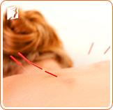 irregular periods acupuncture