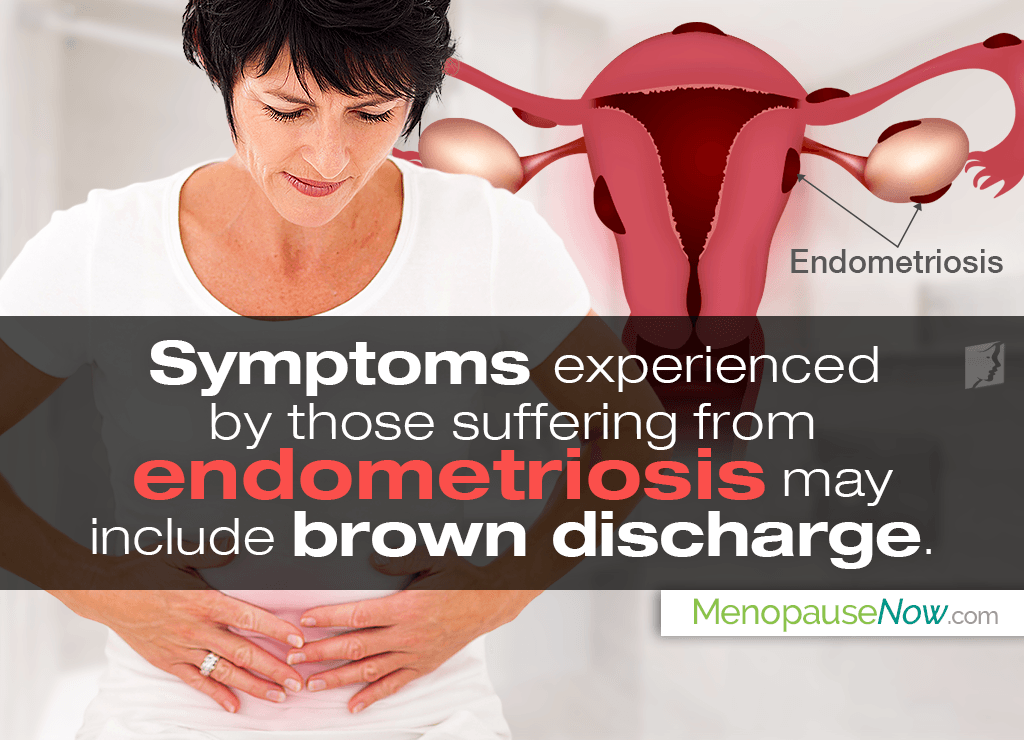 Endometriosis is one of the possible causes behind frequent brown discharge