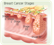 Irregualr periods cancer