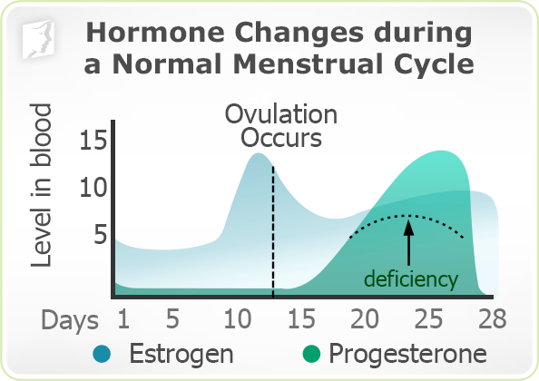 Causes of Irregular Periods1