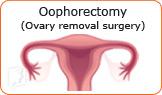 is-early-menopause-genetic-2