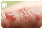 Itchy Bumps on the Skin: Causes
