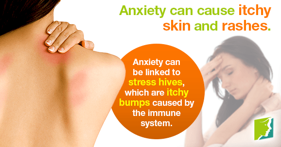 Anxiety can cause itchy skin and rashes.