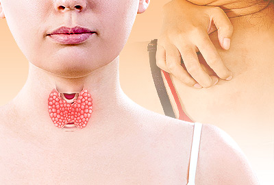 Itchy Skin and Thyroid Problems: Are They Related?