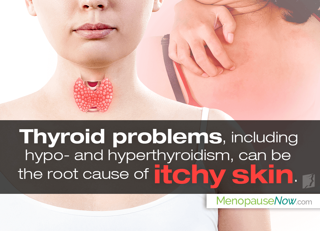 thyroid and itchy skin