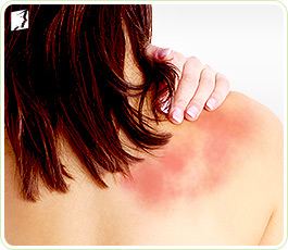Causes of Itchy Skin