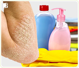 Itchy Skin Other Causes