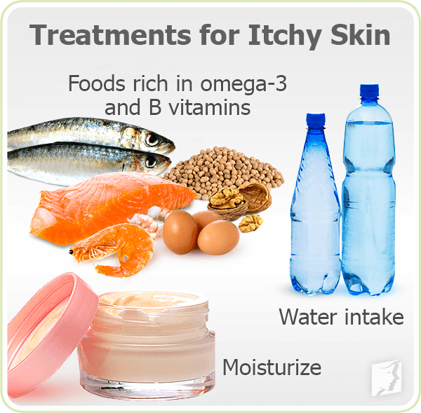 Treatments for Itchy Skin