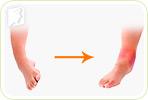 Joint Pain FAQ
