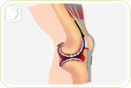 Joint Pain during Menopause?