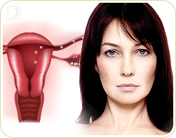 Late and Missed Periods - Causes