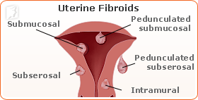 loss-libido-cancer