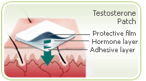 loss of libido hormones