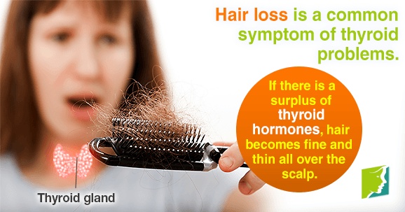 Hair loss is a common symptom of thyroid problems