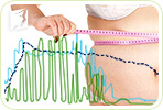 Weight Gain during Menopause