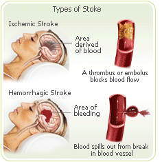 menopause hemorrhagic