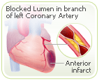 menopause lumen