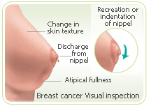 Menopause symptoms cancering