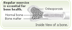 News oteoporosis