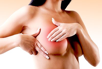 Non-cyclic Breast Pain: Important Things to Know