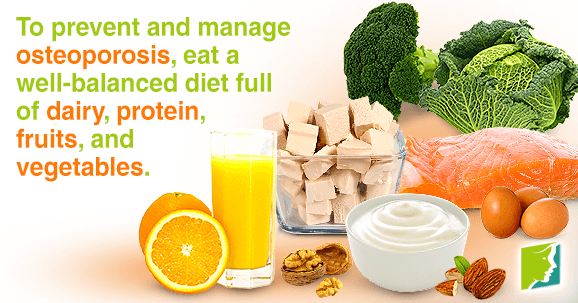 The best way to prevent and treat osteoporosis is through a healthy diet