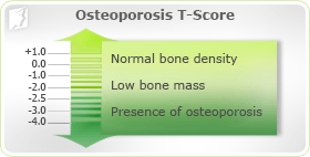 Osteoporosis Risk Factors 1