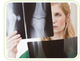 osteoporosis hormones