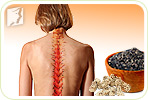 Osteoporosis in Your Spine