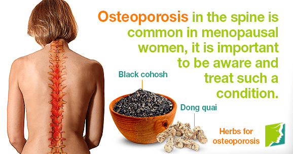 Osteoporosis in Your Spine