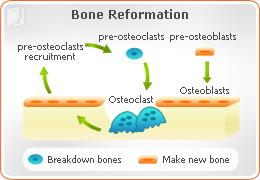 osteoporosis-osteoclasts