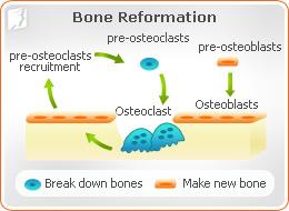 Osteoporosis and Menopause