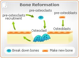 Osteoporosis and Menopause