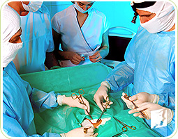 Perimenopause Causes 3