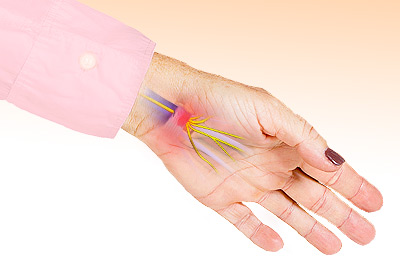 Pin and Needles Sensation in Hands