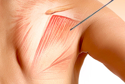 Popular Tests for Muscle Weakness