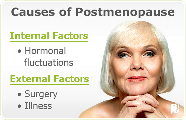 Causes of Postmenopause